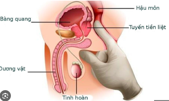 Ung thư dương vật: Nguyên nhân, biểu hiện, cách điều trị và phòng bệnh- Ảnh 1.