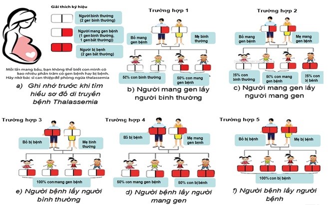 http://vienhuyethoc.vn/wp-content/uploads/2021/04/So-do-di-truyen-thalassemia-Vien-Huyet-hoc.jpg