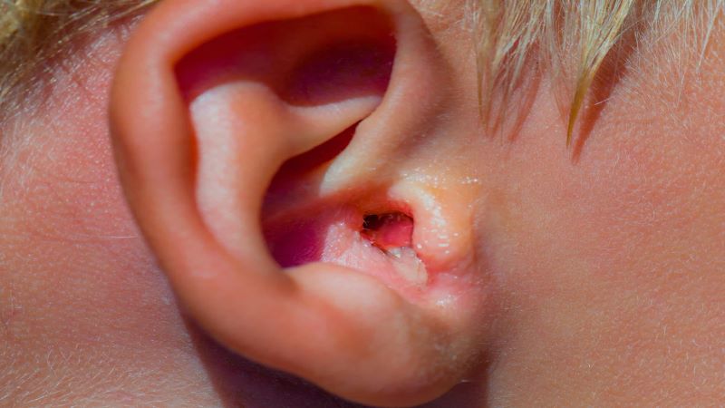 Biểu hiện viêm tai ngoài và cách phòng tránh- Ảnh 1.