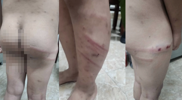 Phú Thọ: Bé trai 11 tuổi bị mẹ ruột và bạn trai bạo hành giữa đêm- Ảnh 1.