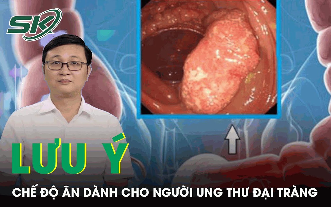 Người bị ung thư đại tràng cần lưu ý gì trong chế độ ăn?