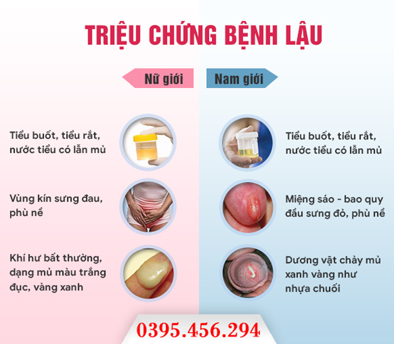 4. Phương pháp chẩn đoán và điều trị bệnh lậu