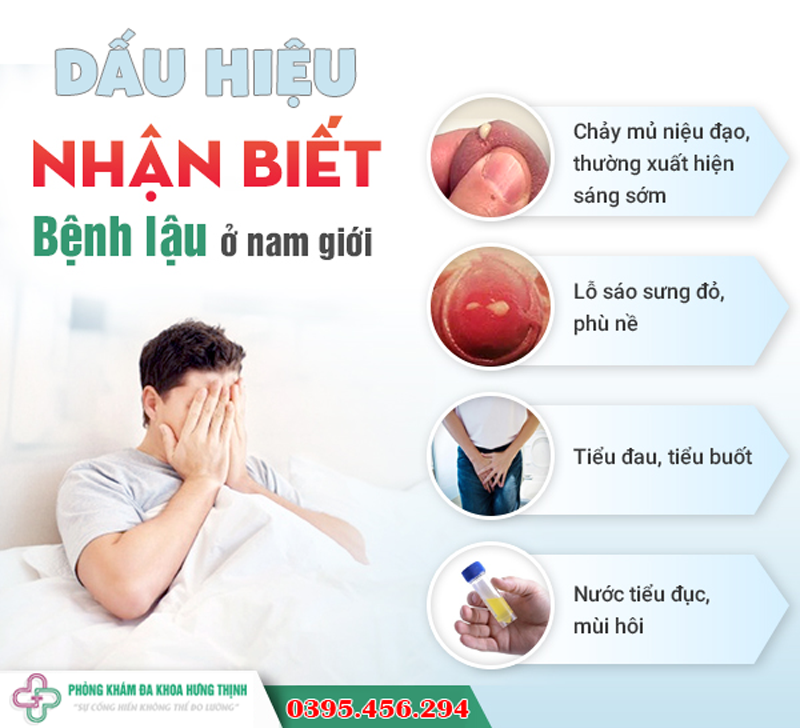 Hướng Dẫn Điều Trị Bệnh Lậu Ở Nam Giới