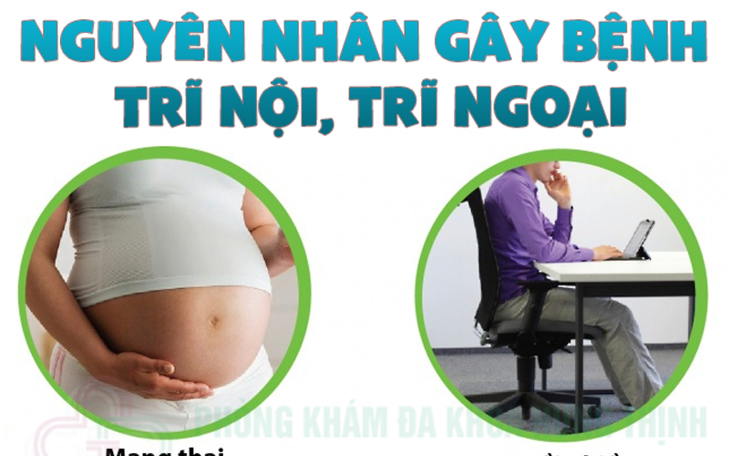 6 dấu hiệu bệnh trĩ nội trĩ ngoại ở nam và nữ thường gặp sớm nhất