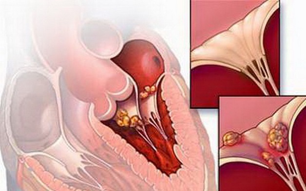 Câu hỏi thường gặp liên quan đến thấp tim