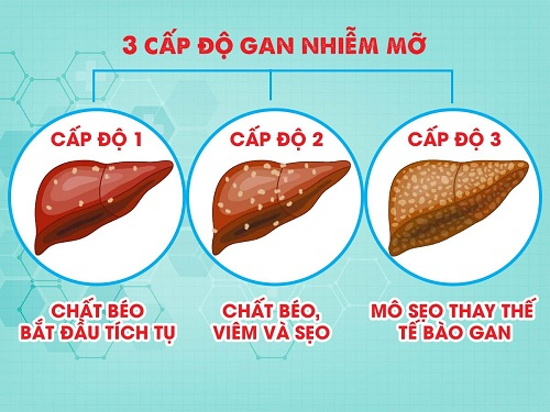 Các dấu hiệu ở da của bệnh gan nhiễm mỡ có thể khác nhau, mức độ nghiêm trọng tùy theo từng cá nhân.