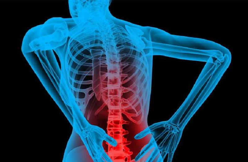 Bệnh lao xương và một số điều cần biết để bảo vệ sức khỏe