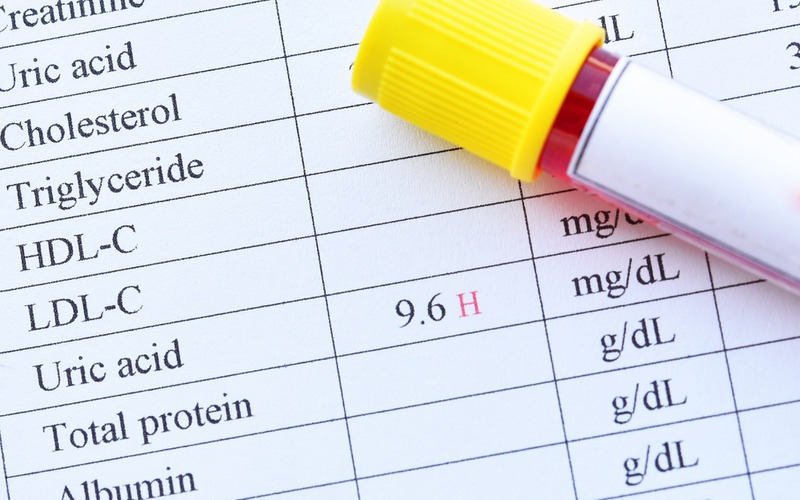 Tăng acid uric máu: Nguyên nhân, biểu hiện, cách điều trị và phòng bệnh