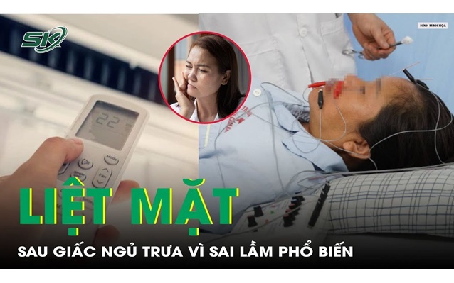 Liệt mặt sau giấc ngủ trưa vì thói quen thường gặp mùa nắng nóng