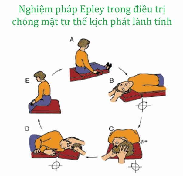 Thuốc và các phương pháp điều trị chóng mặt kịch phát lành tính - Ảnh 3.