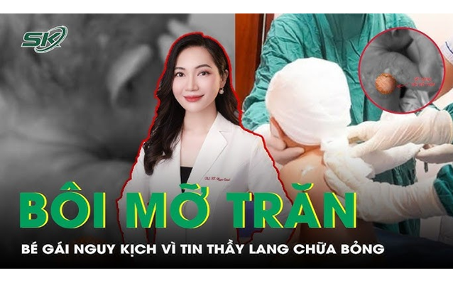 Thầy lang bôi mỡ trăn chữa bỏng canh khiến bé gái nguy kịch