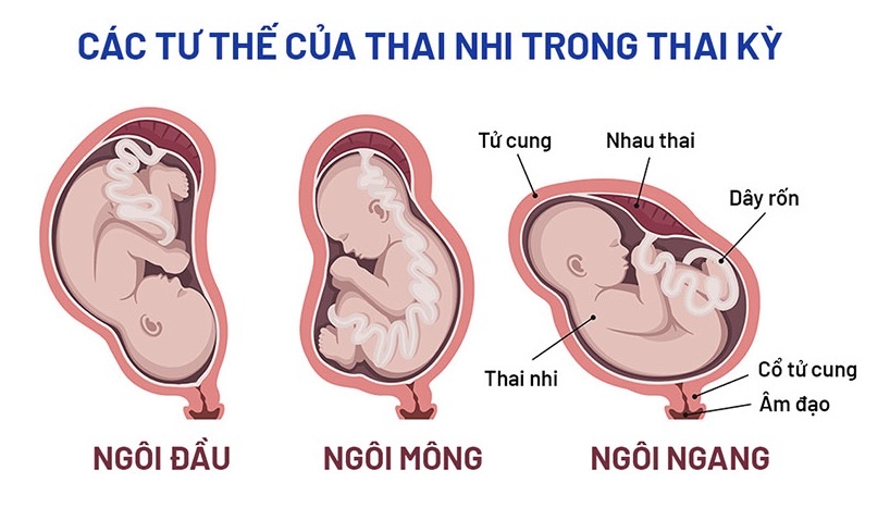 Rỉ ối: Nguyên nhân, triệu chứng và cách điều trị- Ảnh 2.