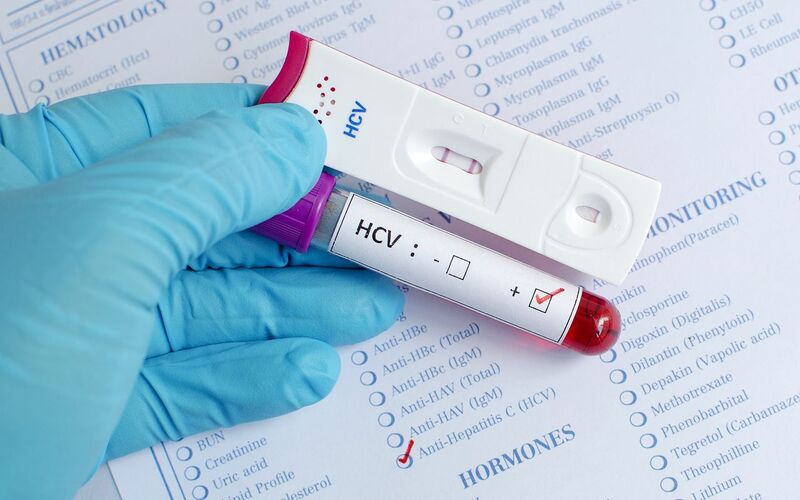 Giải pháp nào cho điều trị đồng nhiễm HIV/viêm gan C?- Ảnh 3.