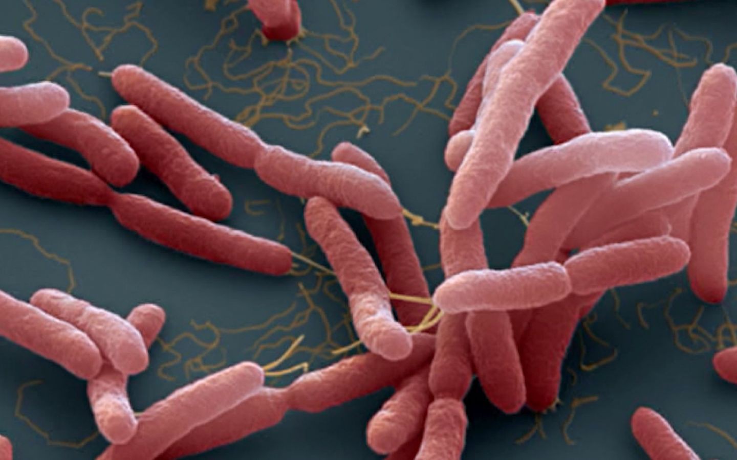 Cứu sống thiếu niên 15 tuổi mắc bệnh Whitmore nguy kịch- Ảnh 3.