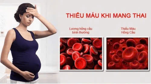 Câu hỏi thường gặp về bệnh thiếu máu- Ảnh 2.