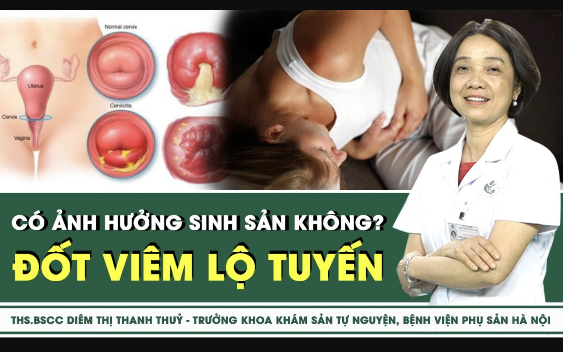 Đốt viêm lộ tuyến cổ tử cung có ảnh hưởng sinh sản không?