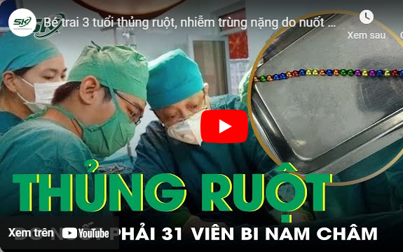 Bé trai 3 tuổi thủng ruột, nhiễm trùng nặng do nuốt 31 viên bi