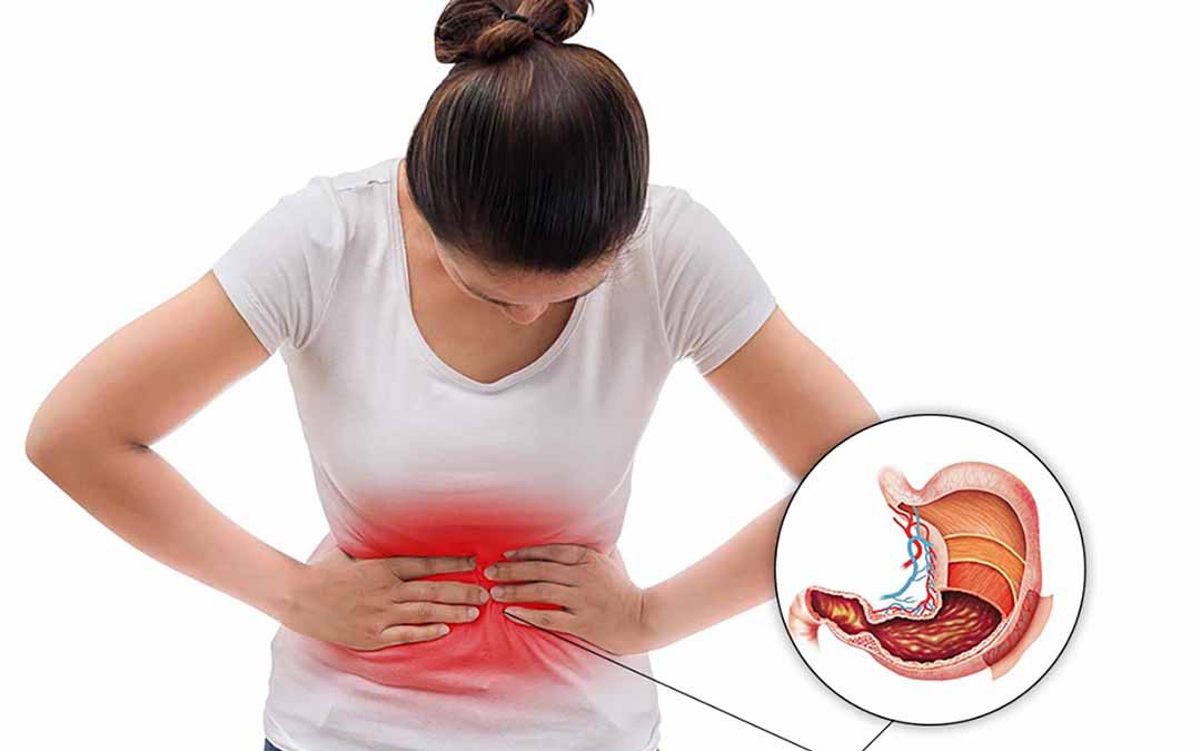 Polyp dạ dày có nguy cơ ung thư không?