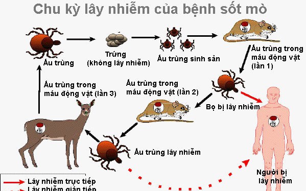 Thuốc nào điều trị sốt mò?