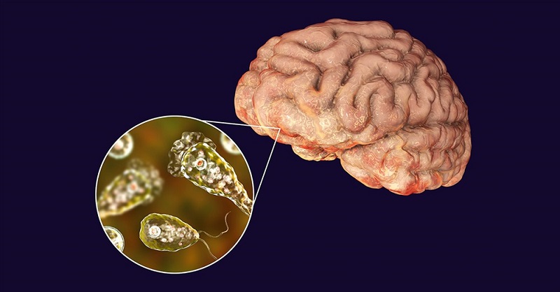 Virus ăn não người: Tất cả những gì bạn cần biết về triệu chứng, điều trị và phòng ngừa