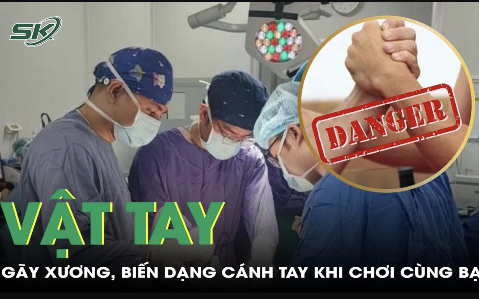 Biến dạng, gãy xương cánh tay sau khi chơi vật tay