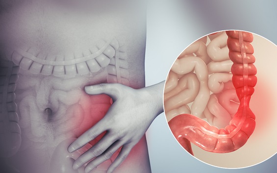 Tiêu chảy kéo dài coi chừng bệnh viêm ruột nguy hiểm- Ảnh 1. Tiêu chảy kéo dài coi chừng bệnh viêm ruột nguy hiểm- Ảnh 1.