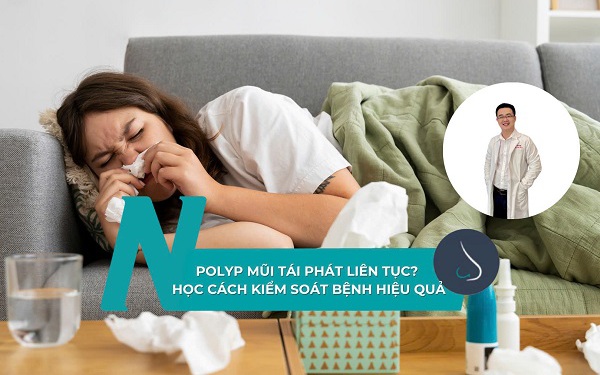 Polyp mũi tái phát liên tục, học cách kiểm soát bệnh hiệu quả
