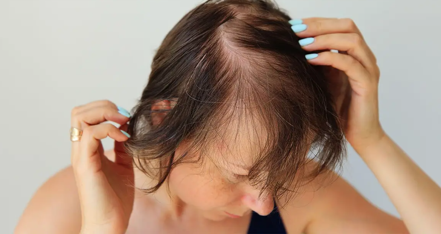 GỘI ĐẦU BẰNG NƯỚC GỪNG GIÚP GIẢM RỤNG TÓC VÀ LÀM SẠCH DA ĐẦU
