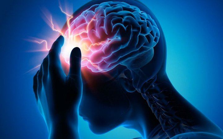 Bé gái bị đau đầu, động kinh, đi khám bác sĩ phát hiện mắc dị dạng mạch máu não