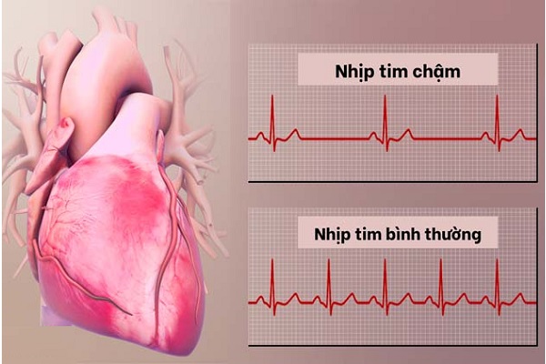 Dấu hiệu tiềm ẩn cảnh báo thiếu iốt, bổ sung bằng cách nào?- Ảnh 1.