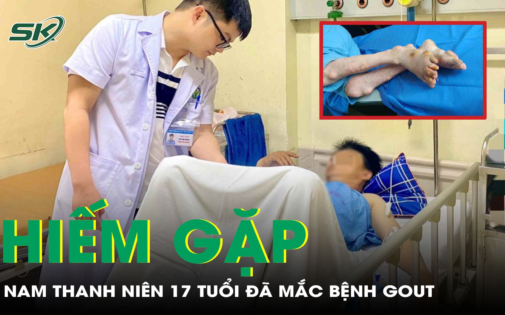 Học sinh 17 tuổi đã mắc bệnh Gout mạn 