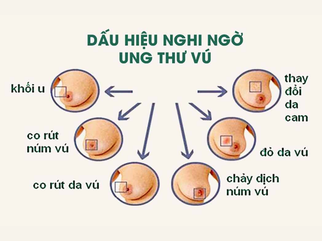 Dấu hiệu nhận biết căn bệnh Diva Hồng Nhung mắc phải, khuyến cáo chị em không được chủ quan- Ảnh 2.