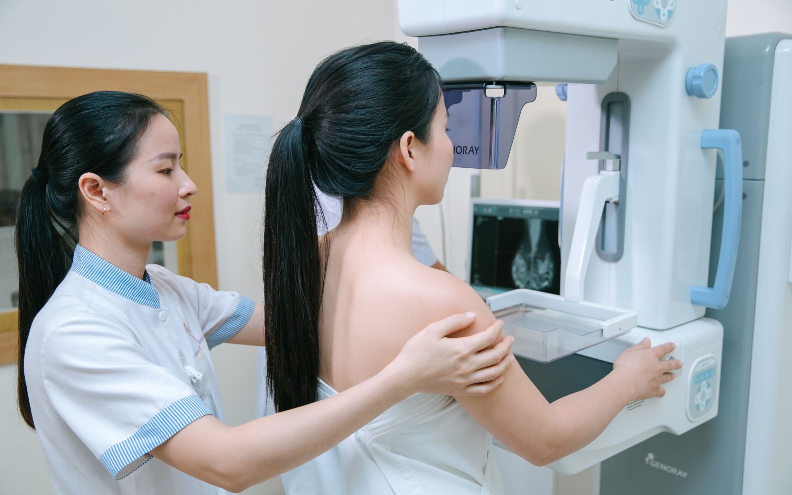 Độ tuổi nên bắt đầu sàng lọc ung thư vú là khi nào?