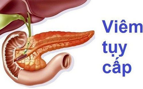 Vì sao uống nhiều bia rượu gây viêm tụy cấp?