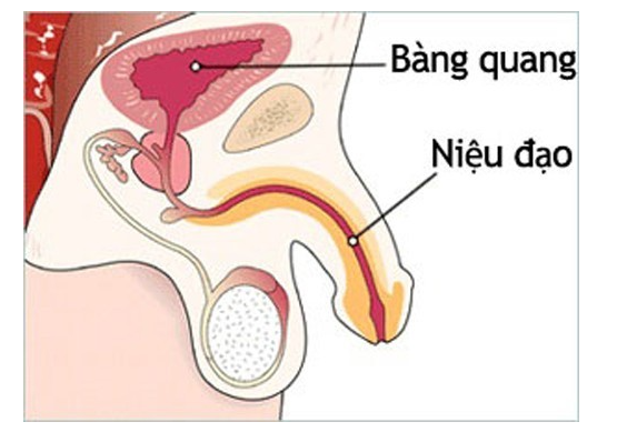 Bệnh nhân hẹp niệu đạo nên có chế độ ăn như thế nào?- Ảnh 1.