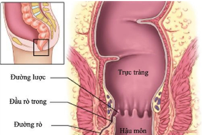Sống tích cực - ‘Liều thuốc’ giúp người có HIV vượt qua kỳ thị- Ảnh 2.