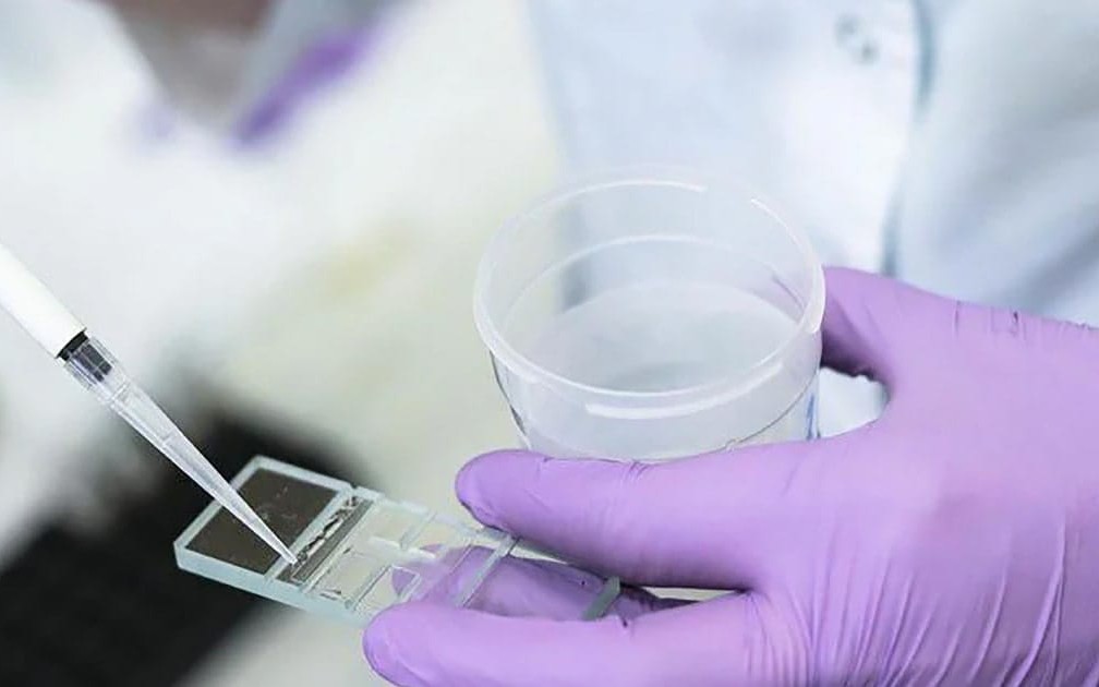 3 chiến lược bảo tồn khả năng sinh sản cho người nhiễm HIV