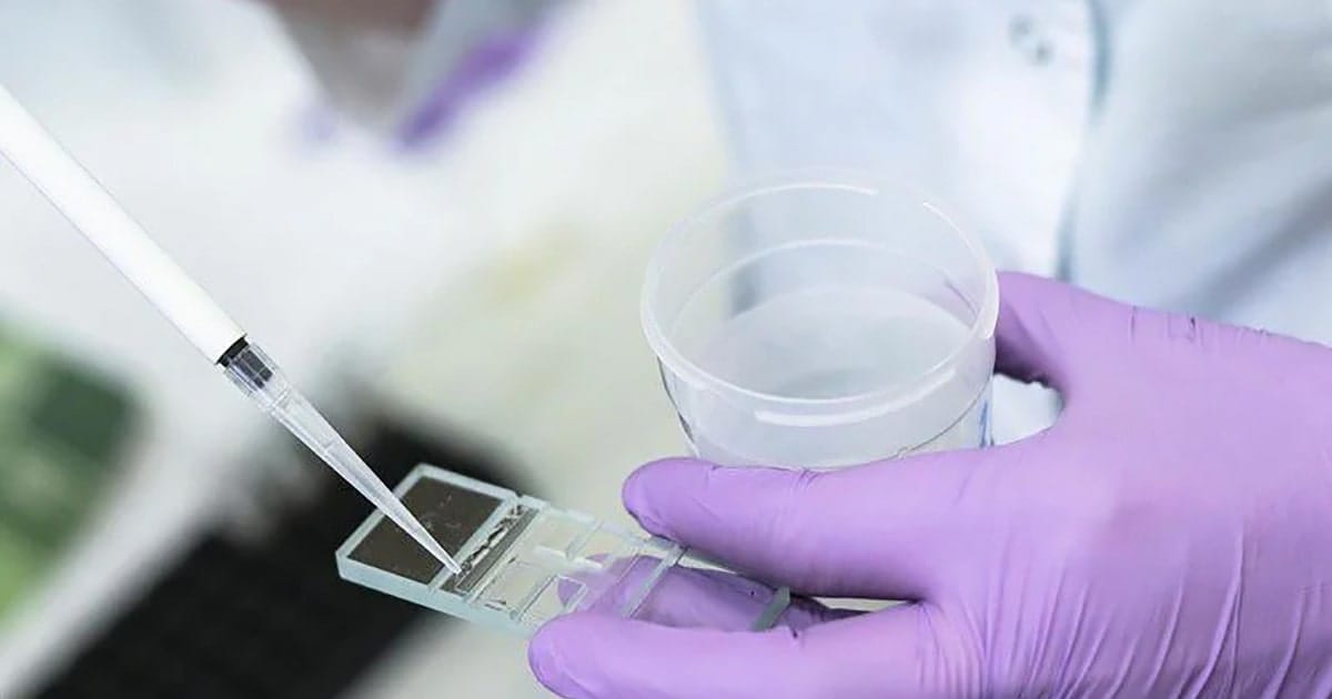 3 chiến lược bảo tồn khả năng sinh sản cho người nhiễm HIV- Ảnh 1. Phương pháp lọc rửa tinh trùng bằng dòng vi dịch (MFSS) | 2025