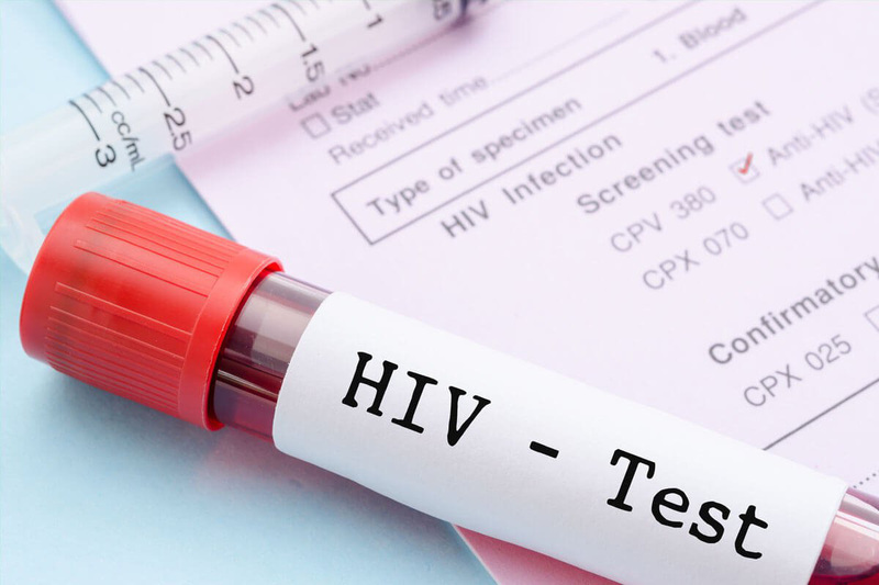 Làm thế nào để biết bạn có bị nhiễm HIV hay không?- Ảnh 1. Làm thế nào để biết bạn có bị nhiễm HIV hay không?- Ảnh 1.