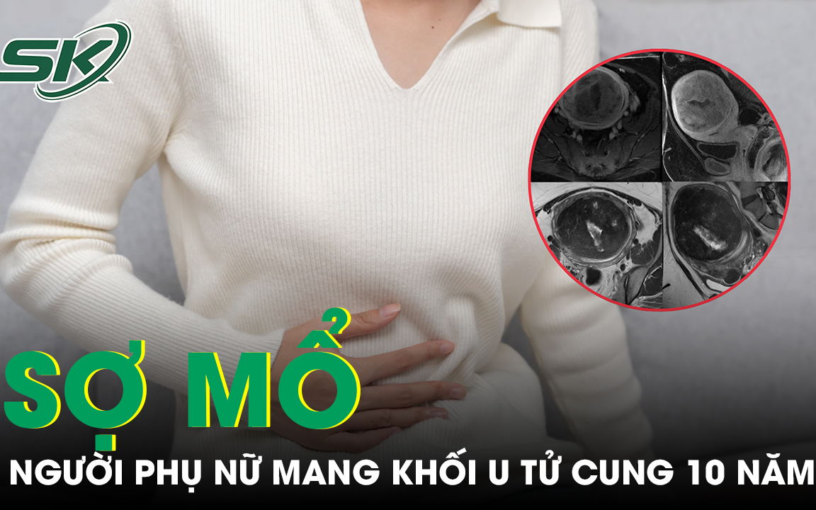 Người phụ nữ đau tức bụng dưới, khó thở, bác sĩ 'lấy ra' khối u xơ tử cung gần 10kg- Ảnh 2. Người phụ nữ đau tức bụng dưới, khó thở, bác sĩ 'lấy ra' khối u xơ tử cung gần 10kg- Ảnh 2.