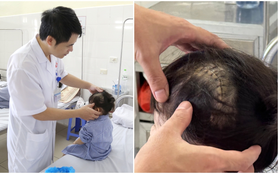 Ca mổ kéo dài 6h cứu cụ ông 81 tuổi thoát cửa tử ngày đầu năm mới- Ảnh 3. Ca mổ kéo dài 6h cứu cụ ông 81 tuổi thoát cửa tử ngày đầu năm mới- Ảnh 3.