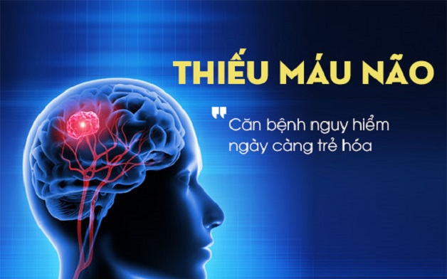 Cơn thiếu máu não thoáng qua: Dấu hiệu cảnh báo sớm nguy cơ đột quỵ- Ảnh 1. Bí quyết giảm nguy cơ cơn thiếu máu não thoáng qua