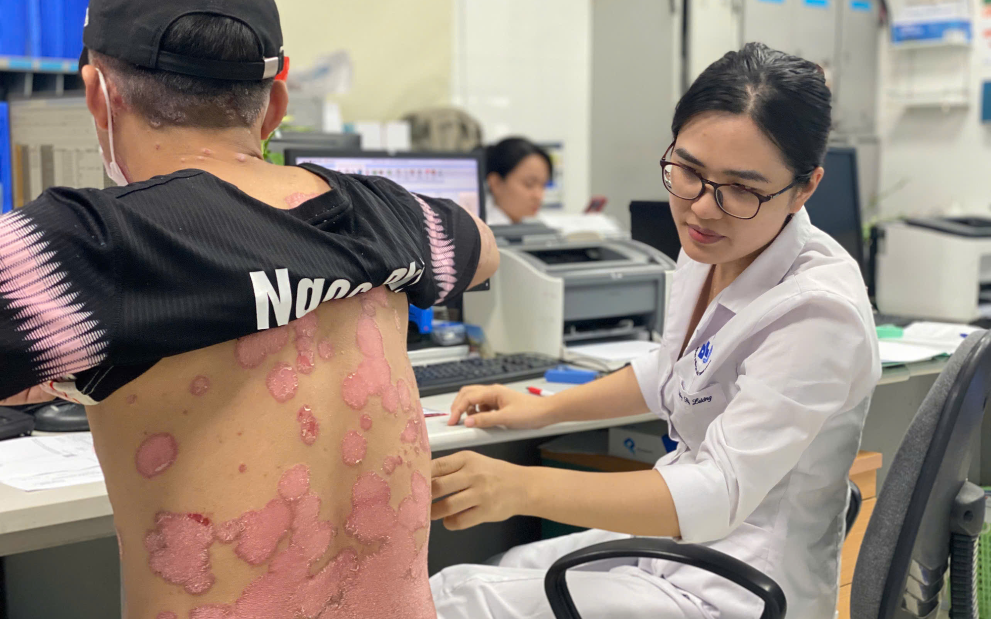 Người dân không còn phải vượt cả trăm cây số để chữa vảy nến- Ảnh 6. Cách ngăn chặn