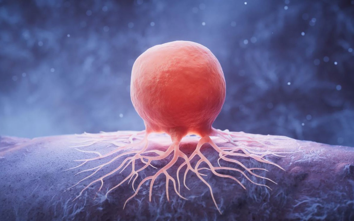 Giảm chất béo có thể 'bỏ đói' tế bào ung thư vú