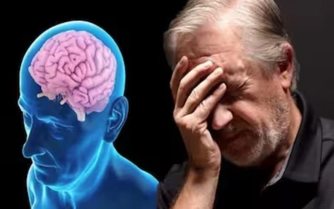 Nguy cơ sa sút trí tuệ và Alzheimer sớm ở người nhiễm HIV- Ảnh 2.