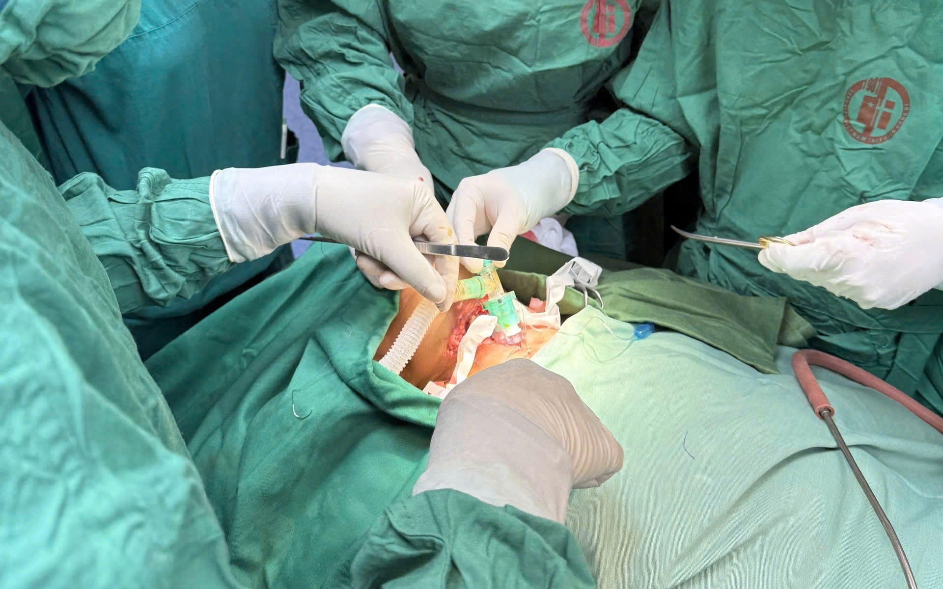 Kích hoạt báo động đỏ toàn viện cứu sống bệnh nhân chấn thương phức tạp vùng cổ