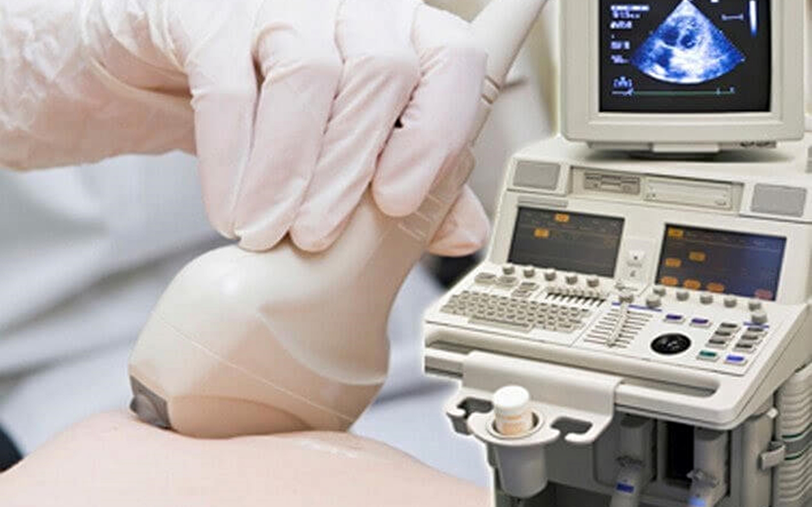 500 phụ nữ được tầm soát ung thư vú miễn phí tại BV Ung bướu TPHCM