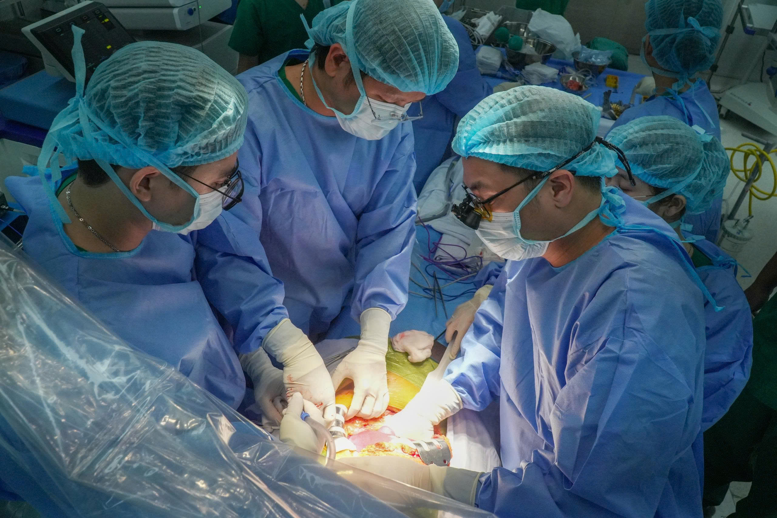 Bước tiến vượt bậc của ghép tạng Việt Nam: Từ ‘đi học’ đến làm chủ kỹ thuật và chia sẻ kinh nghiệm quốc tế- Ảnh 2. Bước tiến vượt bậc của ghép tạng Việt Nam: Từ ‘đi học’ đến làm chủ kỹ thuật và chia sẻ kinh nghiệm quốc tế- Ảnh 2.