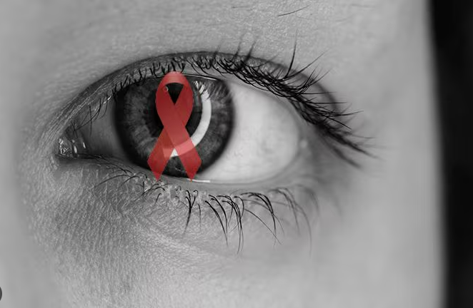 Những bệnh lý tại mắt thường gặp ở người sống chung với HIV- Ảnh 1.