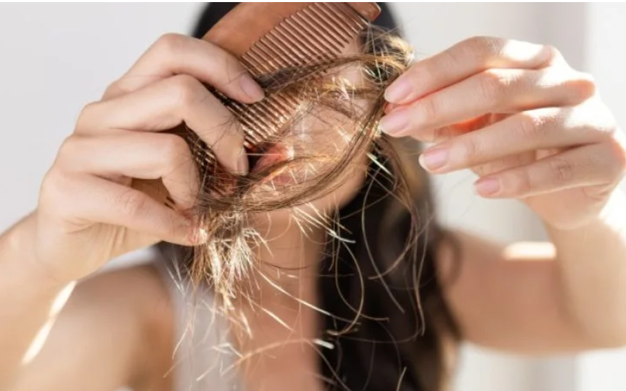 5 nguyên nhân gây rụng tóc hàng đầu và cách chữa tại nhà